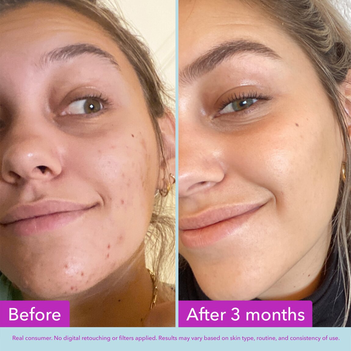 niacinamide-brightening-toner-i2 zb_p.jpg