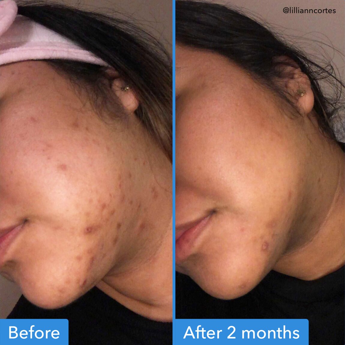 discoloration-correcting-serum-c9 zb_p.jpg