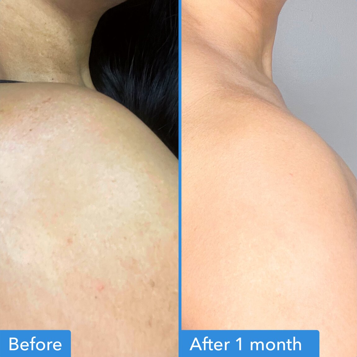 discoloration-correcting-body-treatment-h9 zb_p.jpg